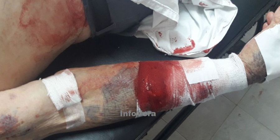 Brutal entradera dejó muy golpeado a un anciano de 89 años en Vera